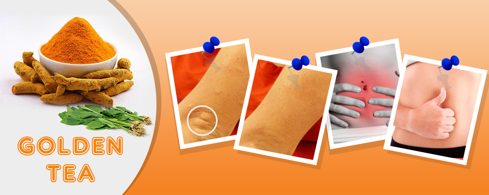 Turmeric – the golden color of health